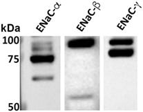 Epithelial Sodium Channel-α Mediates the Protective Effect of the TNF-Derived <mark class="highlighted">TIP Peptide</mark> in Pneumolysin-Induced Endothelial Barrier Dysfunction
